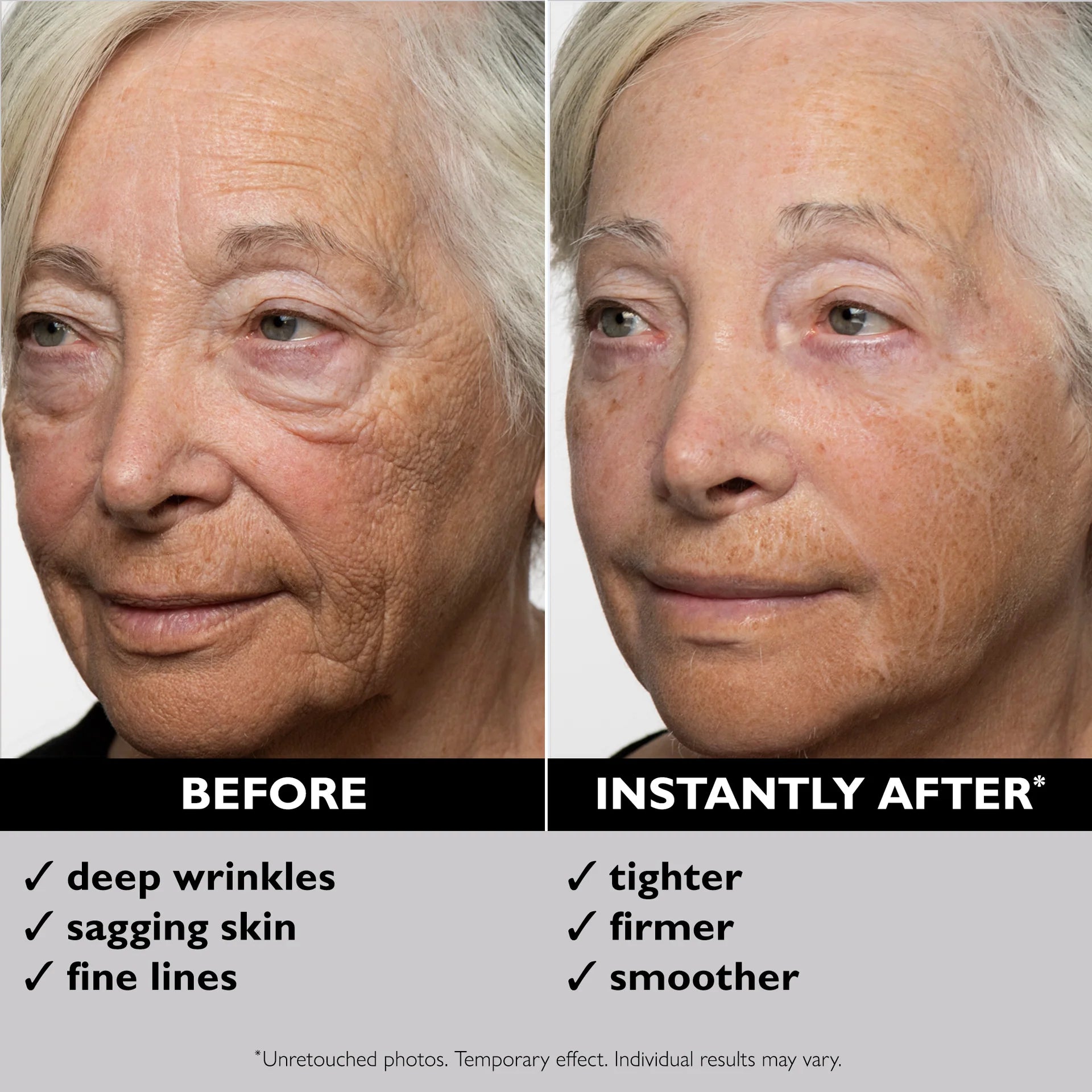 Instant FIRMx Temporary Face Tightener
