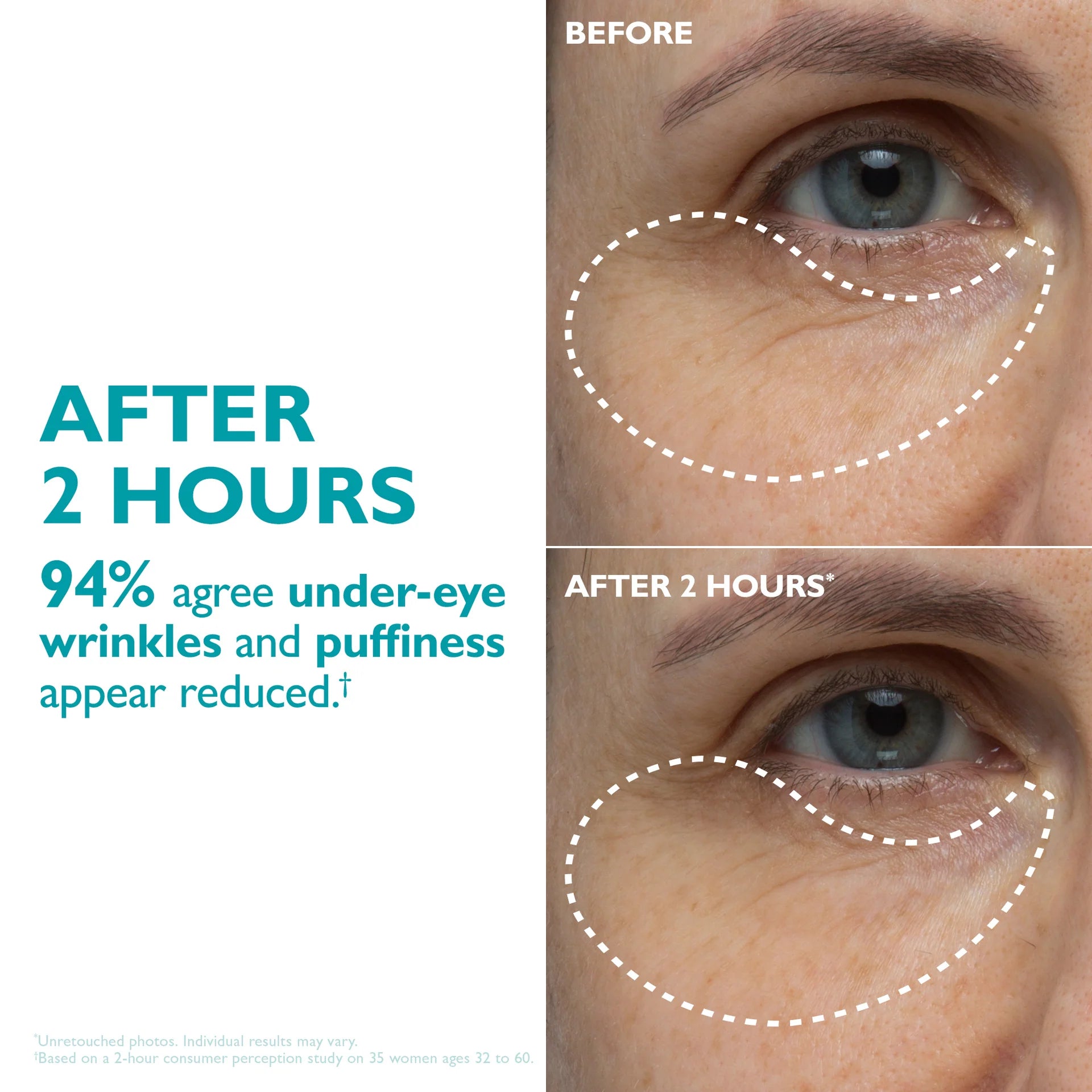 Peptide Skinjection Peptide Infused Face + Eye Tape