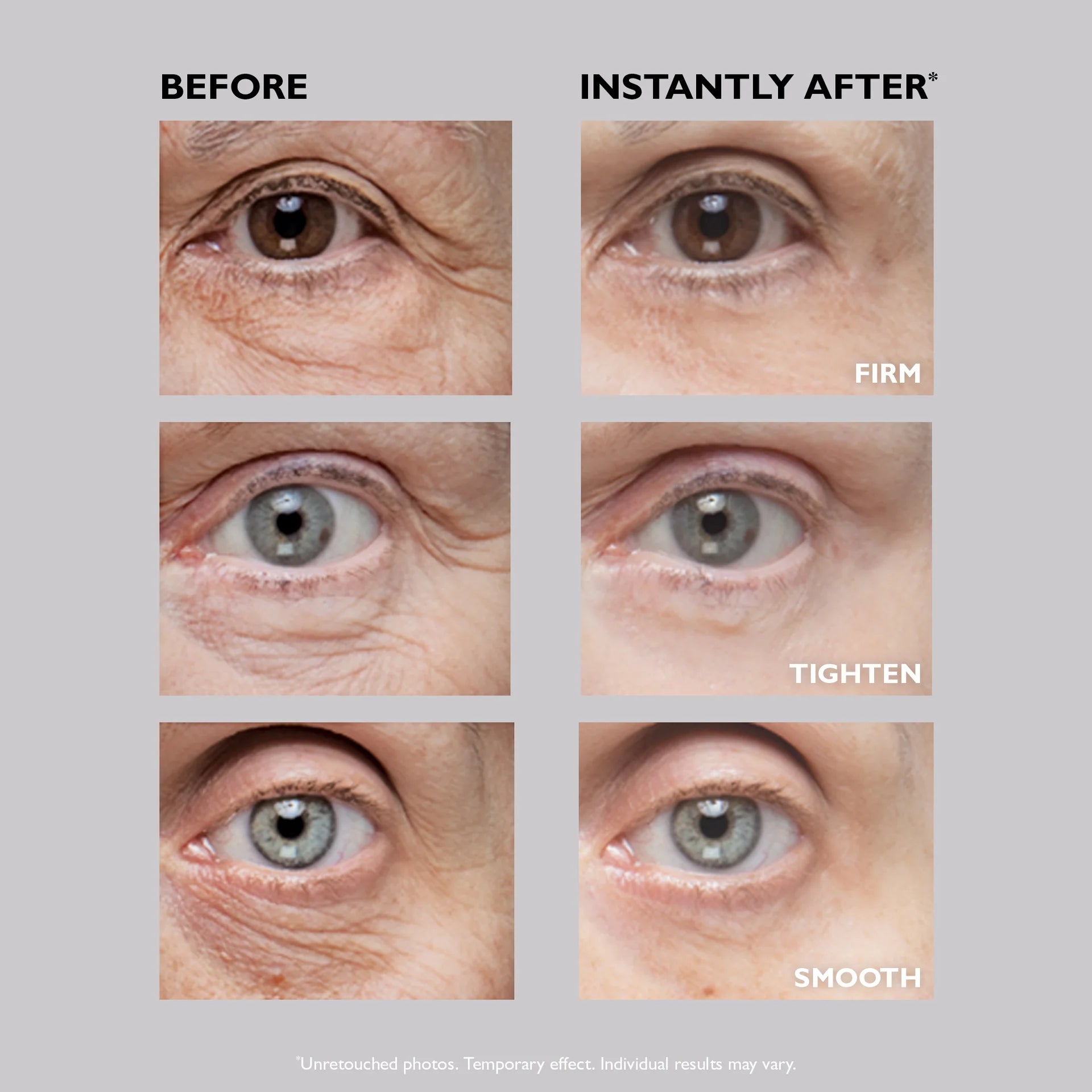 Instant FIRMx Eye Temporary Eye Tightener